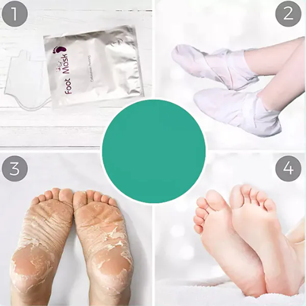 Fußmaske zur hornhautentfernung Clearance